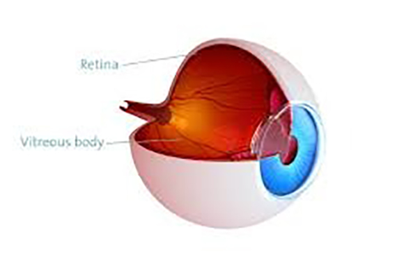 Cirurgia de Retina