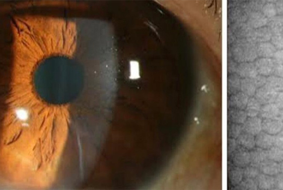 Microscopia Especular